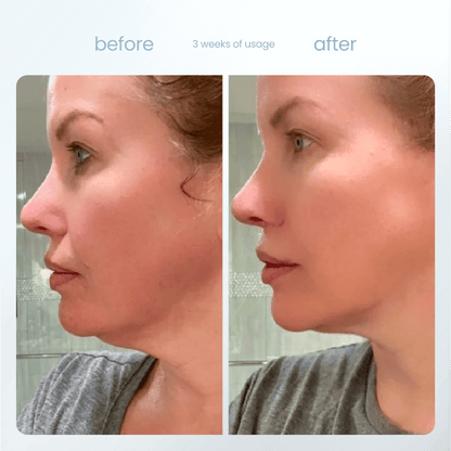 SERENITY - 7 in 1 Facial Sculptor